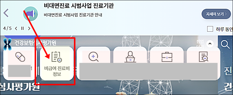 임플란트 가격 비교