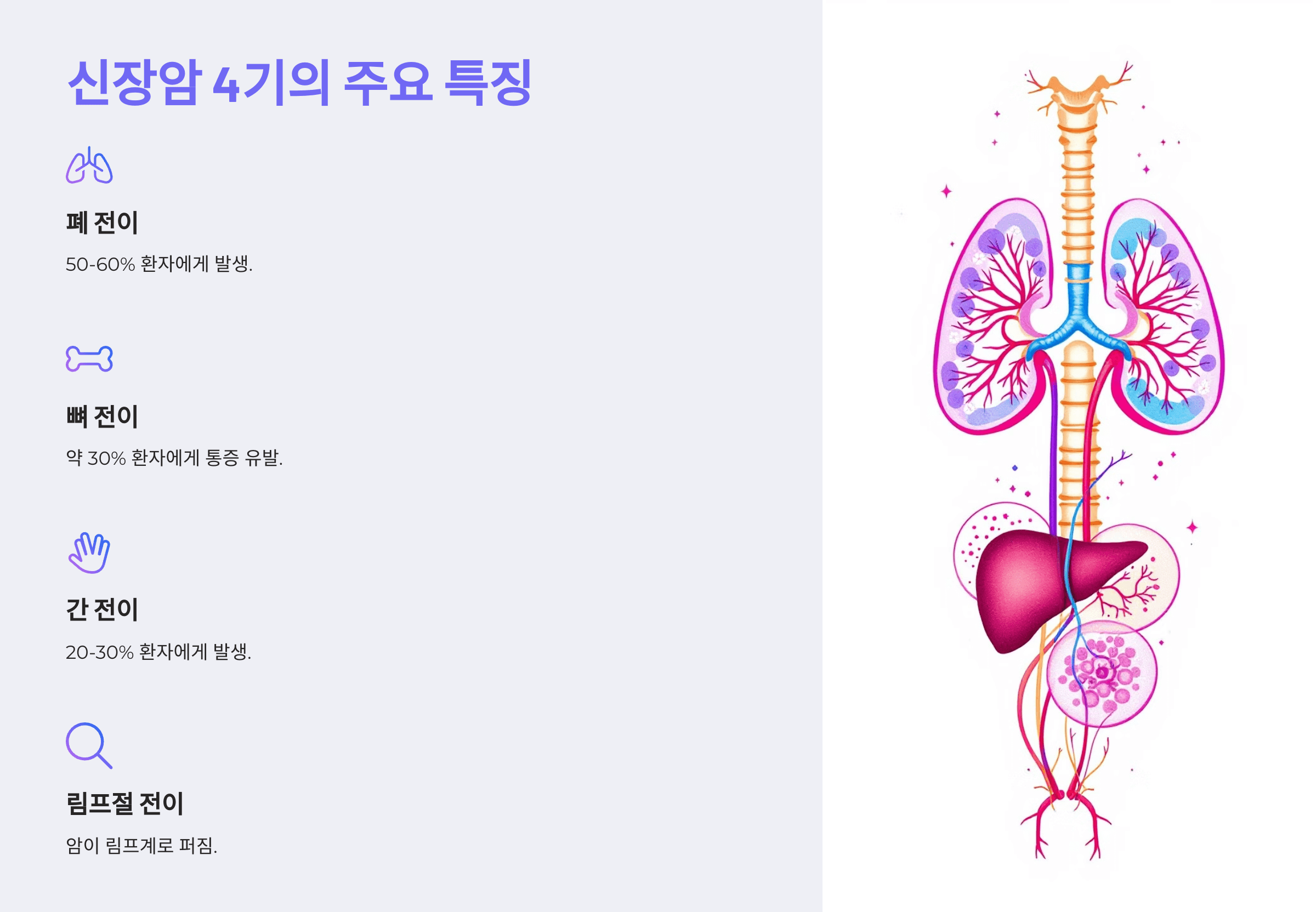 신장암과 관련된 사진입니다.