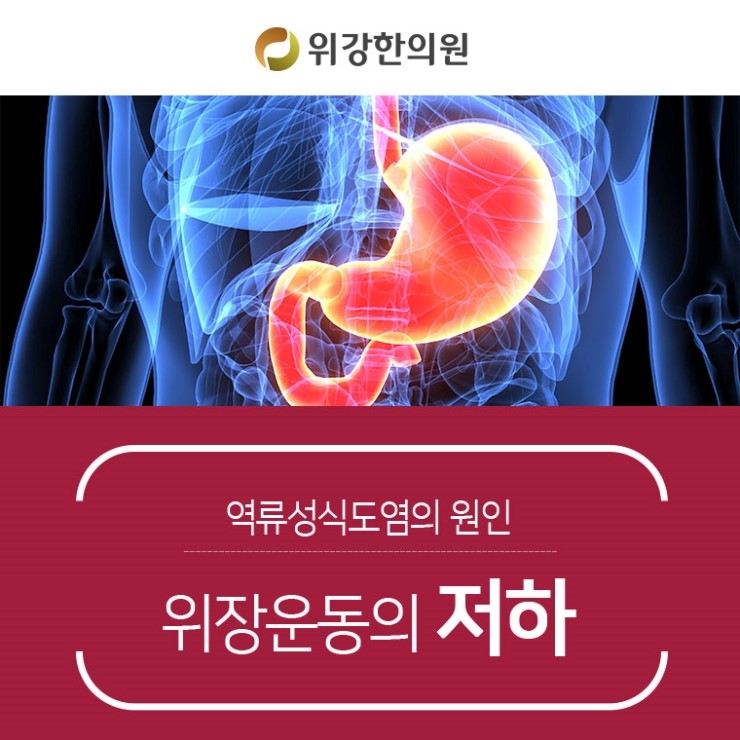 역류성 식도염 증상 가슴 통증 역류성식도염 가슴통증 8