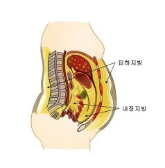 내장지방 위험도