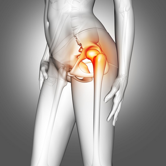 hipbone-neuralgia