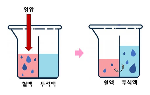 한외여과(초여과)