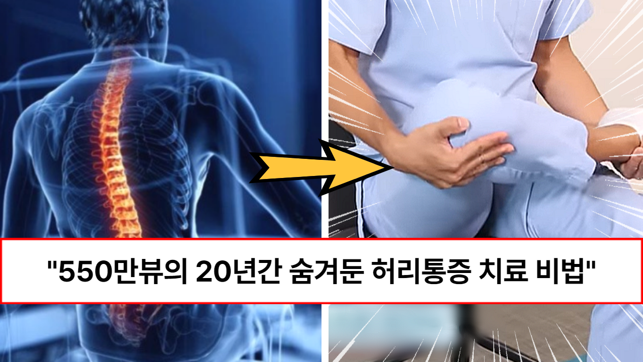 “딱 5분이면 30년된 통증이 사라집니다” 허리, 엉덩이, 종아리 통증에 수술없이 초간단한 5분 스트레칭