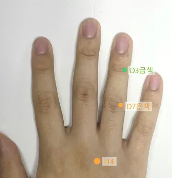 두통 수지침 편두통 혈자리_3