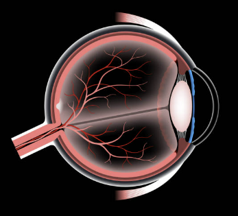 망막 박리 초기 증상과 빠른 대처법 확인
