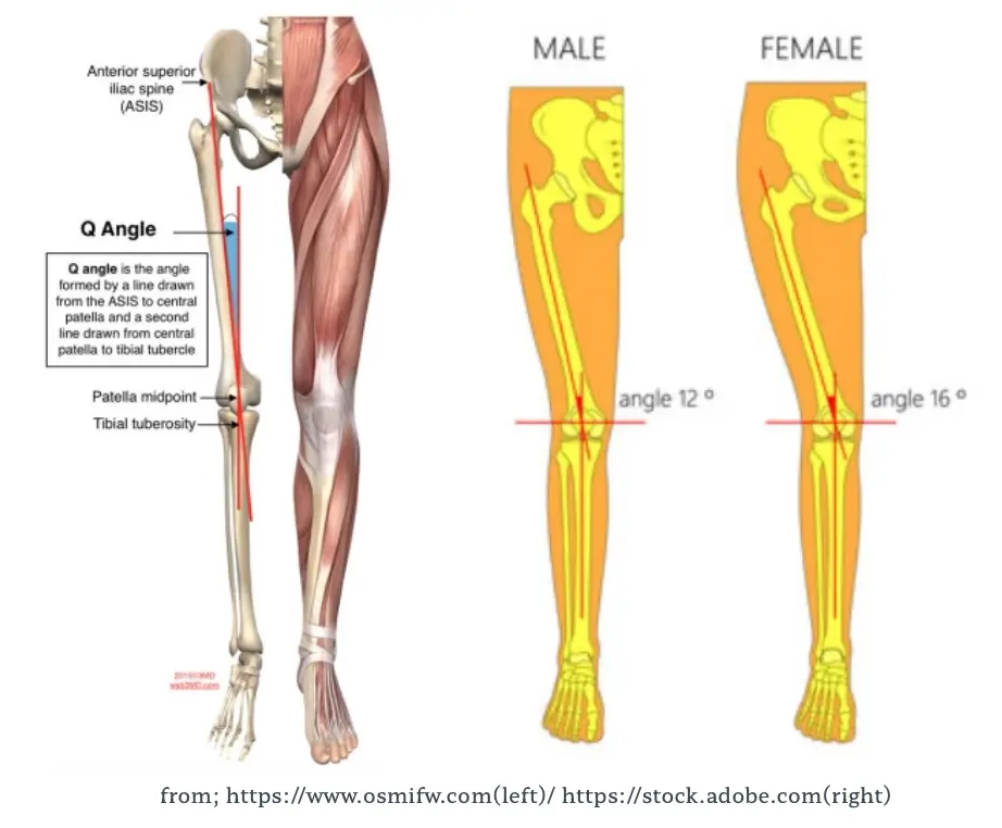 슬개대퇴통증증후군: 원인, 증상 및 효과적인 관리 방법