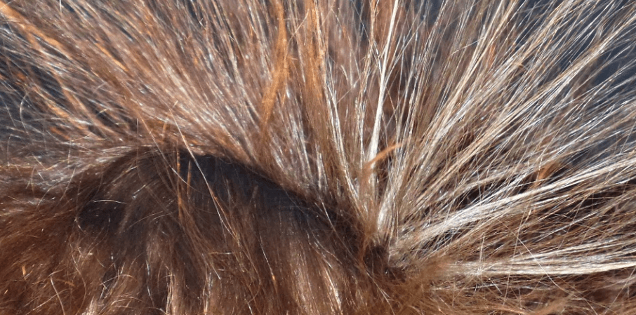 정전기가 발생한 머리카락