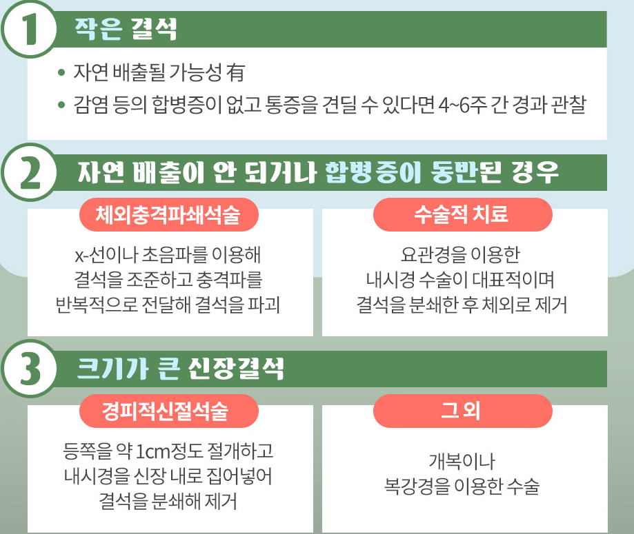 요로결석 증상, 원인, 치료방법