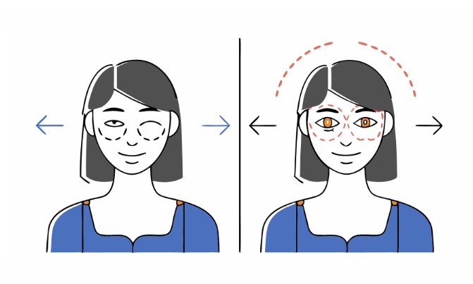 앞트임 수술 과정