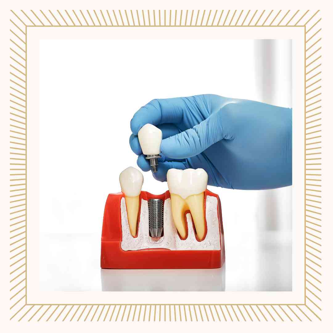 임플란트 건강보험