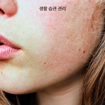 갱년기 여드름 왜 생길까 (2025)|피부 트러블 원인과 관리법