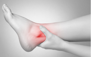 통풍 증상 - 발가락 통증