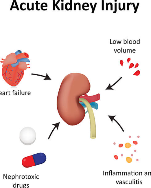 급성 신부전과 관련된 사진1