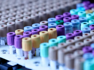 혈액순환 장애 증상 대처법