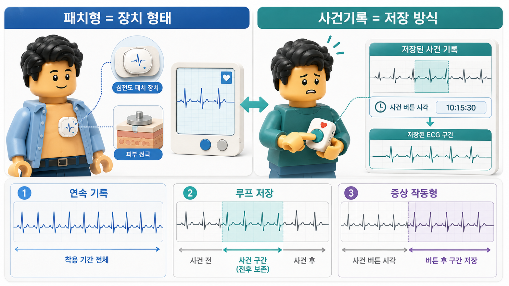 패치형 심전도와 사건기록심전도의 차이 및 연속 기록&middot;루프 저장&middot;증상 작동형 기록 방식을 비교한 의료 인포그래픽