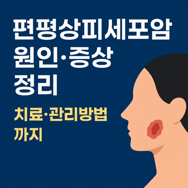 편평상피세포암의 원인, 증상, 치료 및 관리 방법을 설명하는 대표 이미지