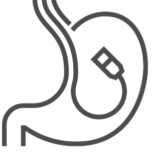 대장내시경 전 음식 주의사항과 대장내시경 약 복용법