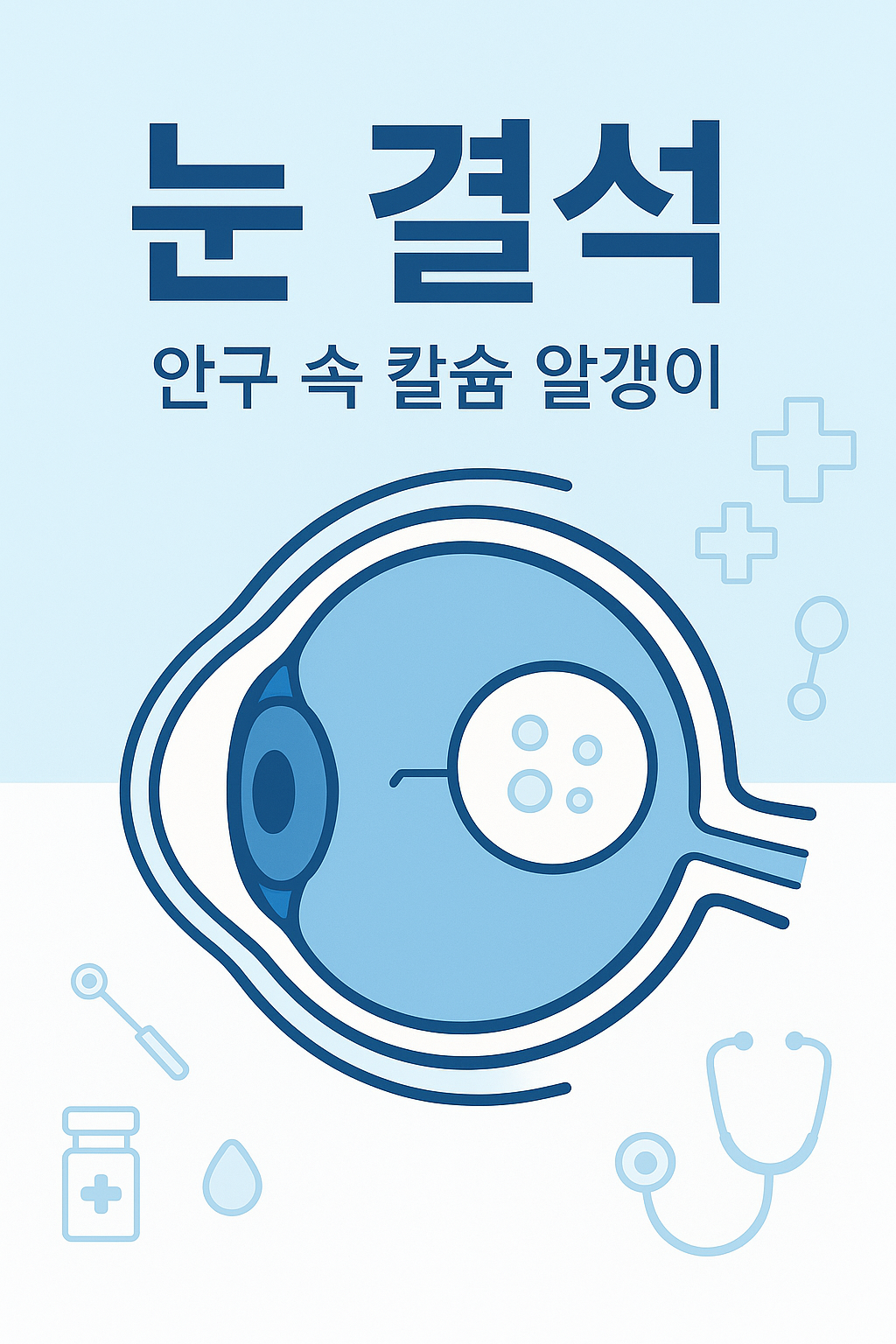 눈 결석, 안구 속 칼슘 알갱이 이야기