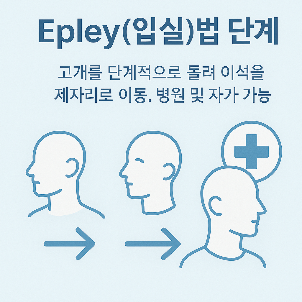 Epley법으로 머리와 몸의 위치를 단계적으로 조정해 이석을 제자리로 이동시키는 과정과 병원·자가 치료 가능성 설명