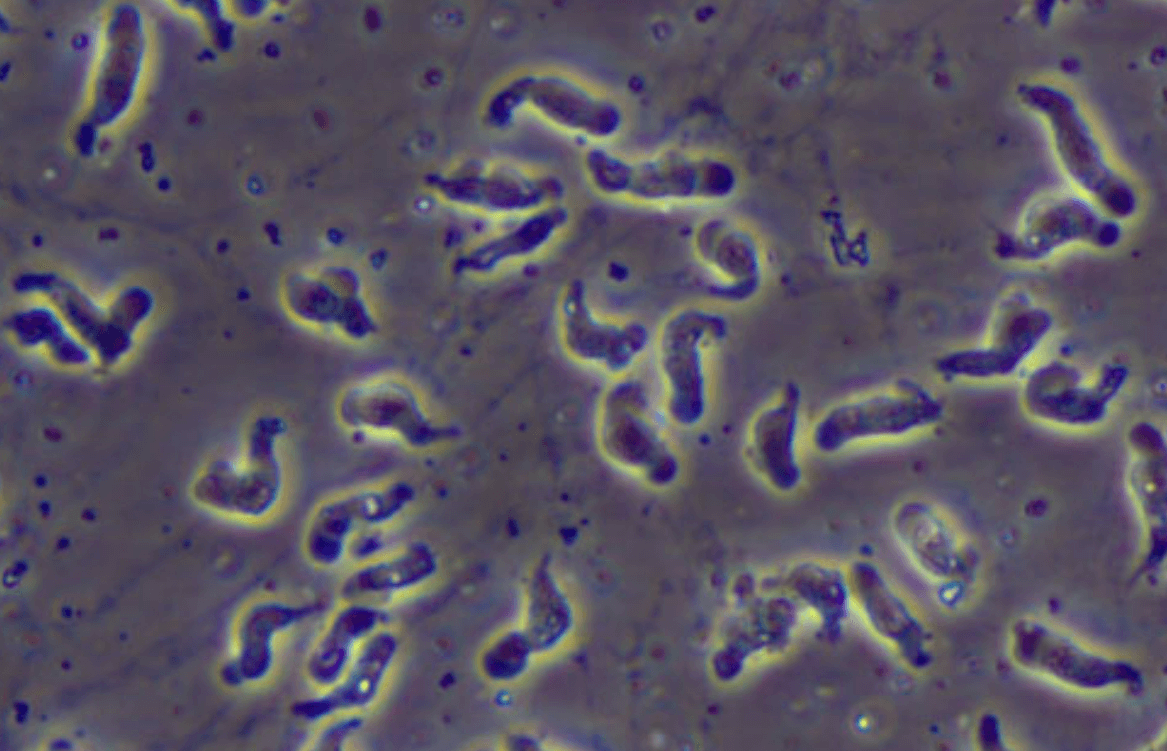 미국 뇌 먹는 아메바 네글레리아 파울러리