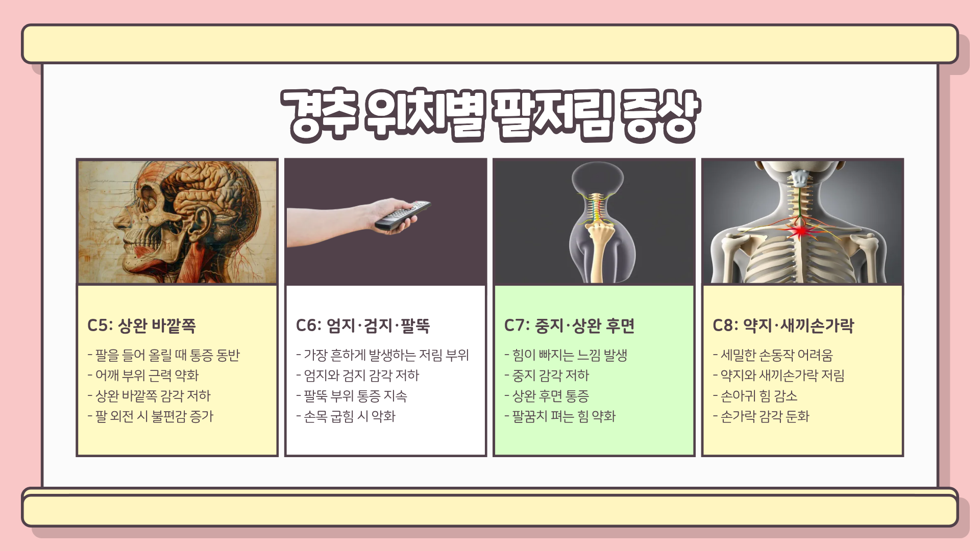 목디스크 증상 | 목디스크 팔저림 | 목디스크 두통 | 목디스크 하반신까지 이어지는 위험 신호 총정리