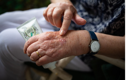 소론도정 관절염 치료