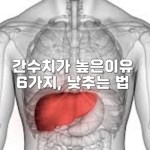간수치가 높은이유 6가지, 낮추는 법