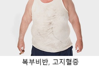 갱년기