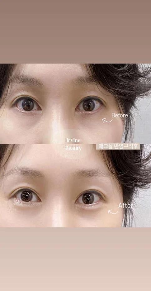 어바인뷰티 Irvine Beauty