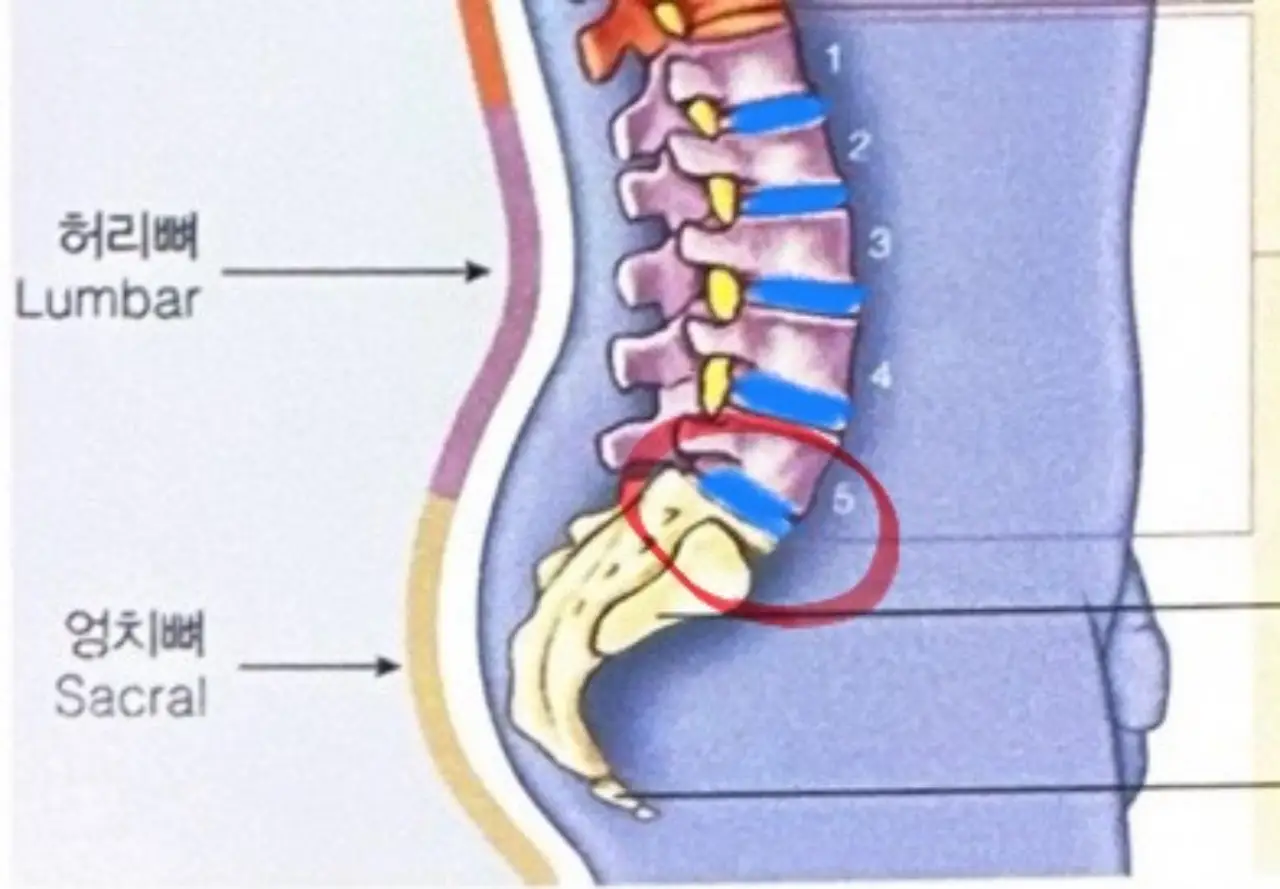 허리-디스크-척추