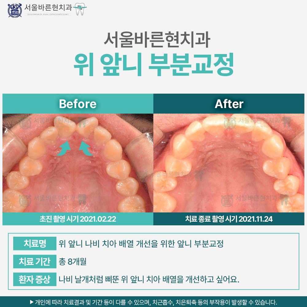 마린시티교정치과