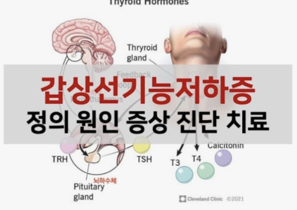 갑상선 기능 저하증 증상