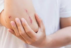 파상풍의 위험성