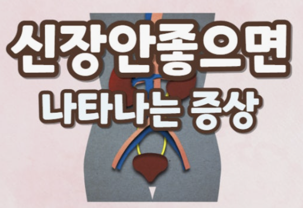 신장이 안좋으면 나타나는 증상