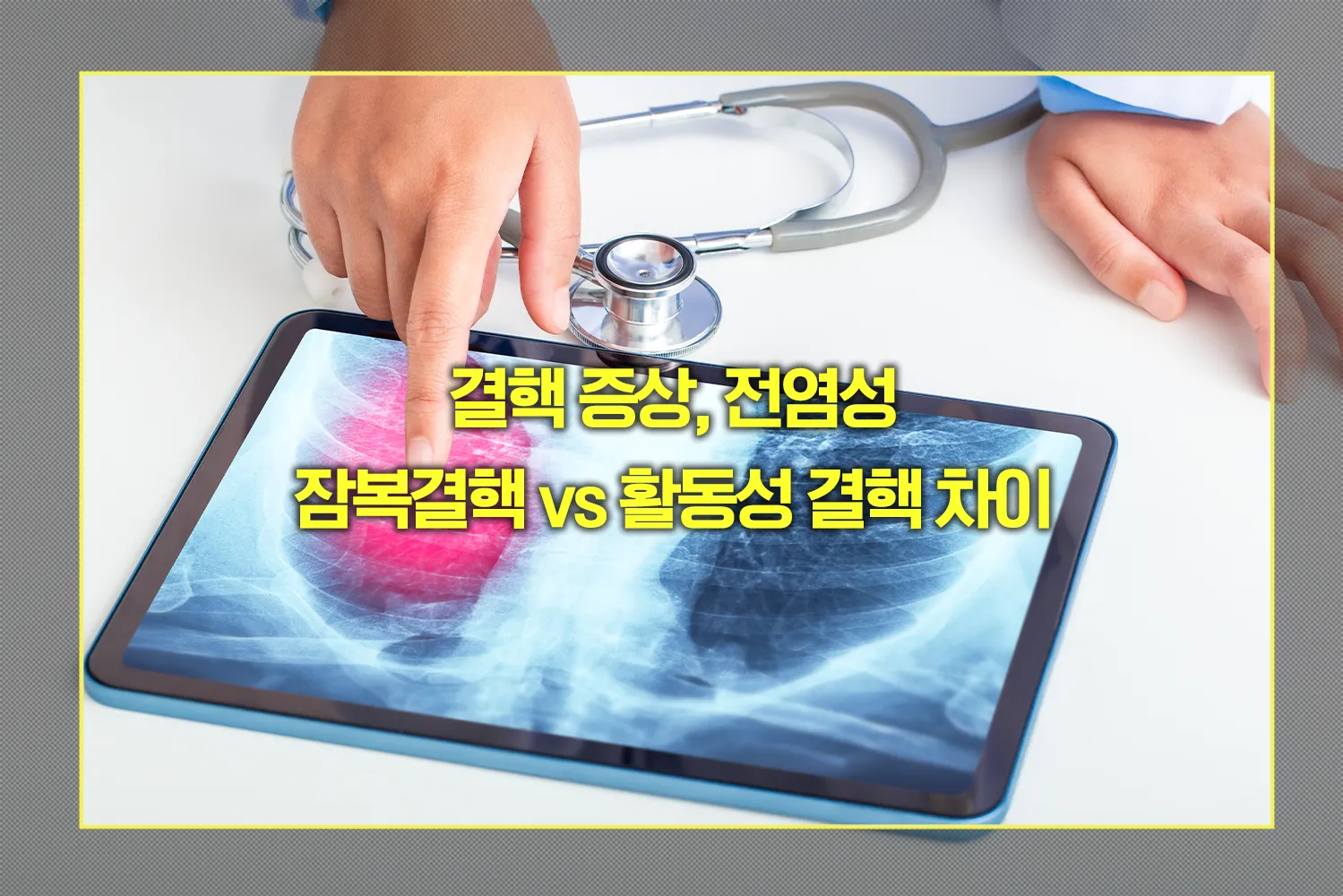 결핵 증상, 전염성