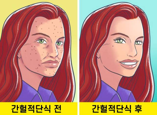 간헐적단식 한달 효과,피부 세포 재생