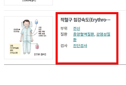 신장 검사방법 알아보기
