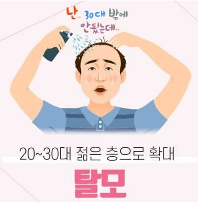 탈모치료
