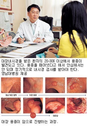 무엇이든 물어보세요 암의 씨앗 0기에 찾아라 대장 용종과 대장암 조기 발견 및 걸릴 확률 높은 위험한 대상과 예방법 정보 추천 오늘방송 정보 다시보기