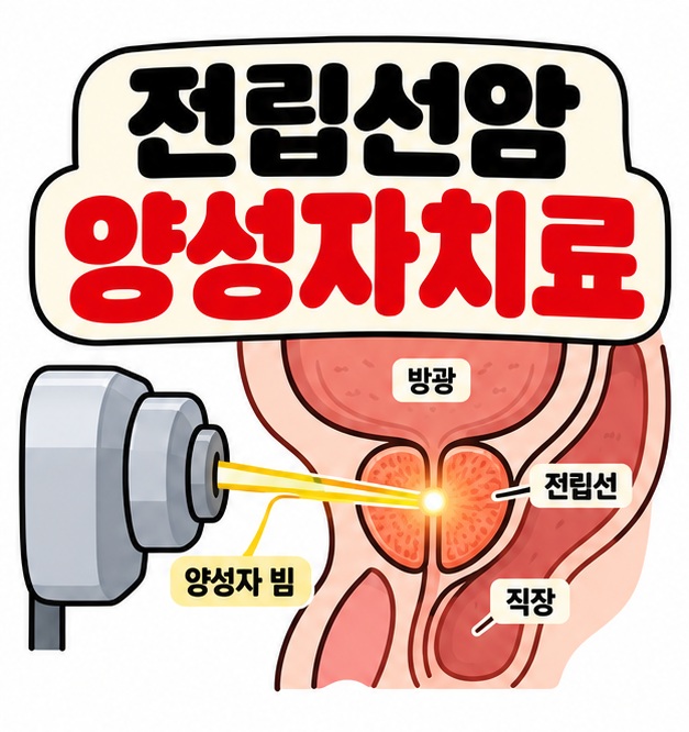 양성자 빔과 전립선 방광 직장 그림 옆에 전립선암 양성자치료 문구를 크게 보여주는 대표 카드