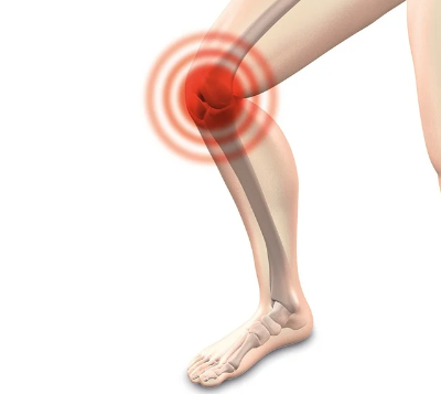 퇴행성 관절염 예방법 – 무릎 건강 지키는 생활습관 가이드