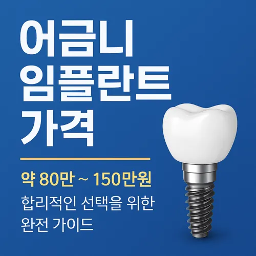 어금니 임플란트 가격과 치과별 비용 차이 썸네일