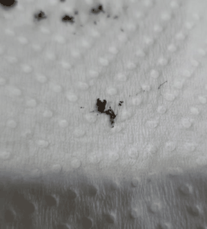 뿌리파리 애벌레