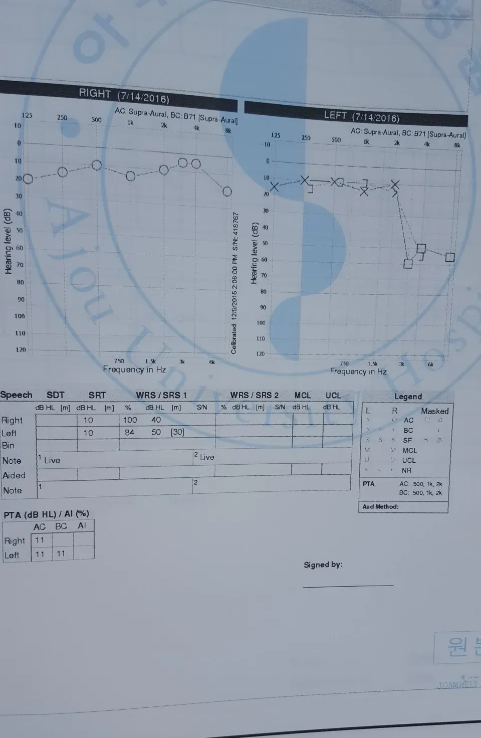 2016년 7월 14일자 아주대병원 청력검사 결과지