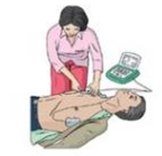 자동 제세동기, 자동 심장충격기(AED)의 사용법