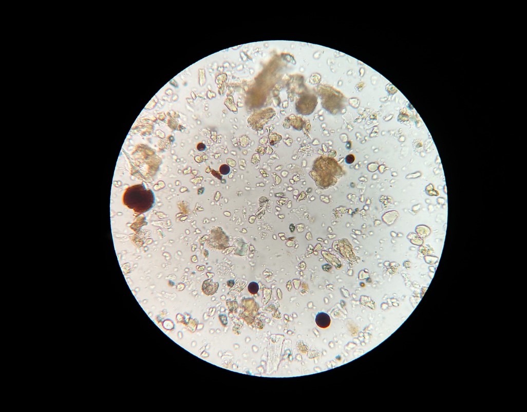 장내 미생물군이 전신 질환에 미치는 영향과 메커니즘