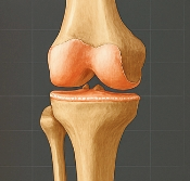 무릎 연골 손상 증상