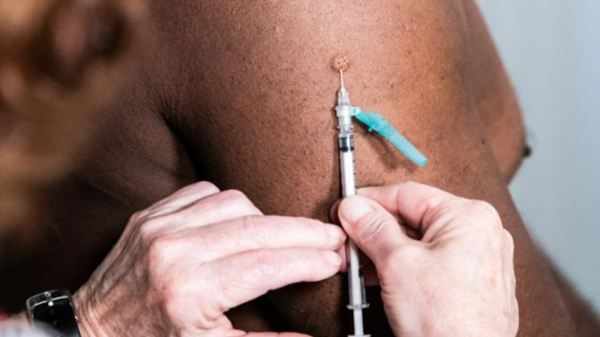 엠폭스-증상사진-감염경로