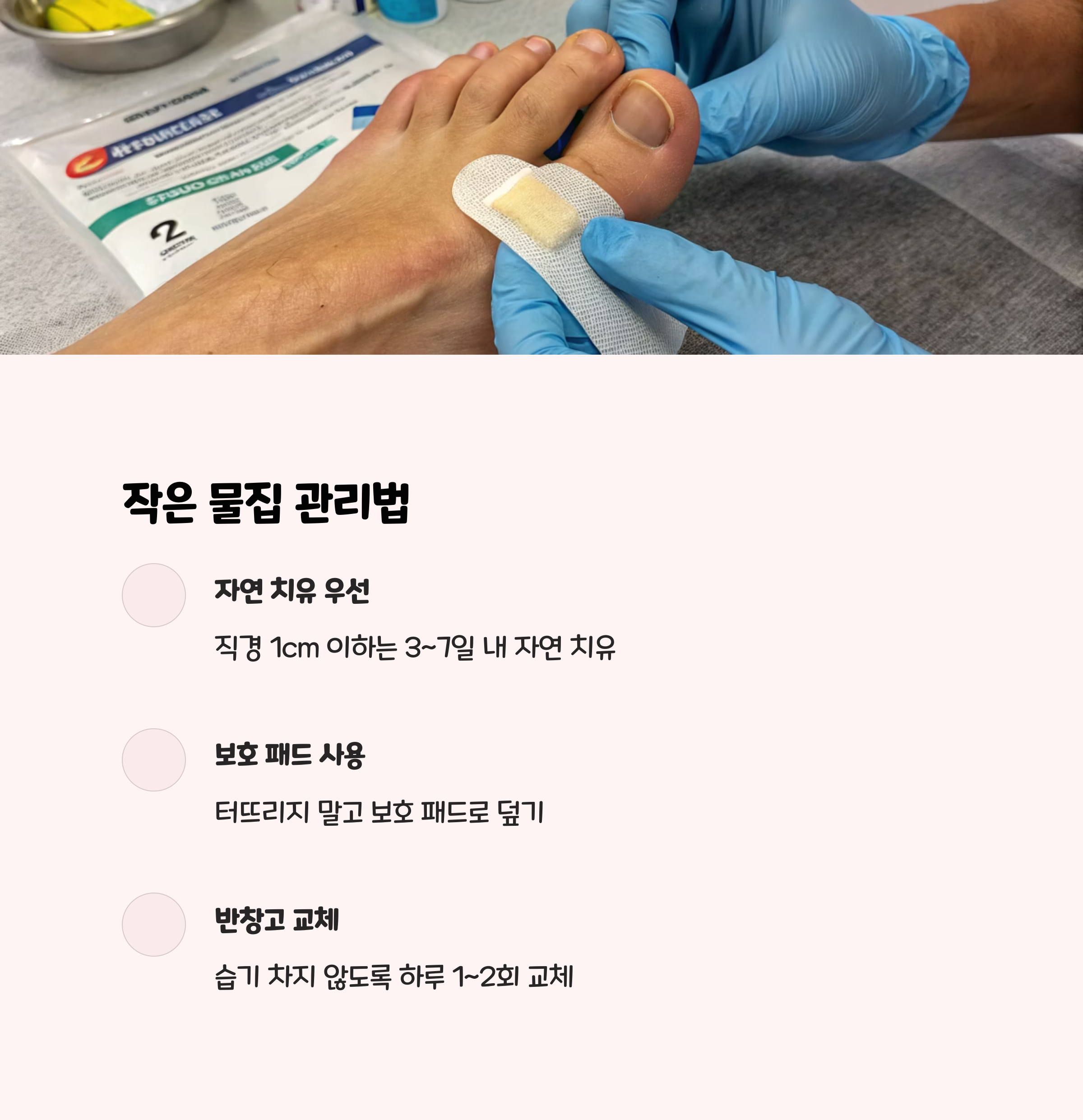작은 물집이라면 자연 치유를 우선하세요