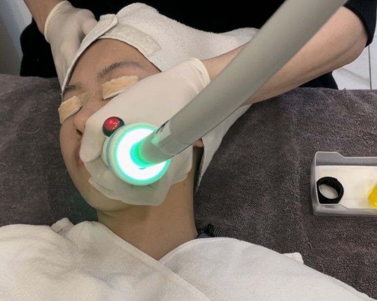 온다 리프팅 후기